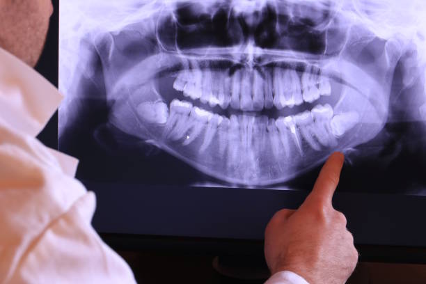Best Emergency Tooth Extraction in Farmersville, CA